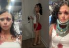 “Free Karmelo!” — Texas Woman Claims She Was Racially Targeted By Black Girls, Viciously Beaten Outside Bar