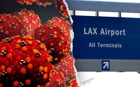 Measles-infected traveler may have exposed passengers at LAX and nearby hotel, health officials warn