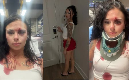 “Free Karmelo!” — Texas Woman Claims She Was Racially Targeted By Black Girls, Viciously Beaten Outside Bar